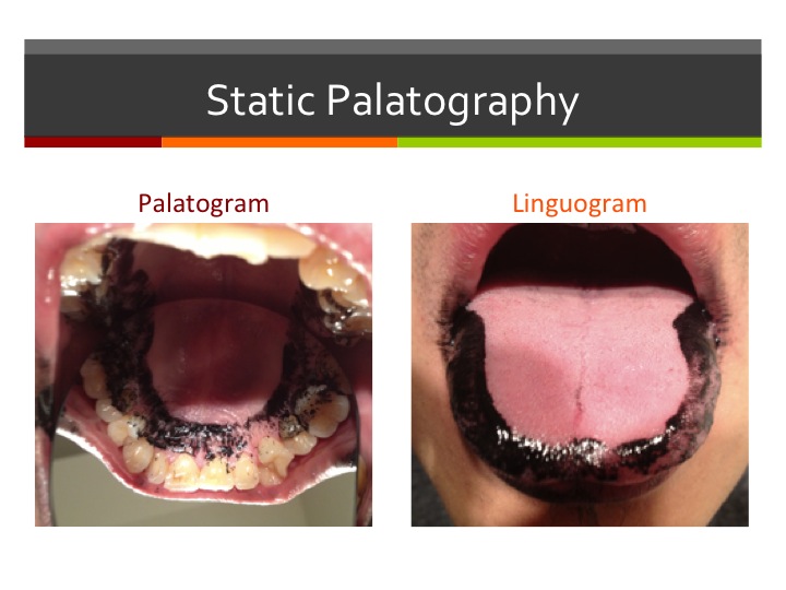 A Learner’s Guide to Static Palatography